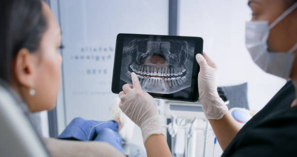 Licensed Teeth Whitening service in Pinebluff, NC - Smile Center Dentistry